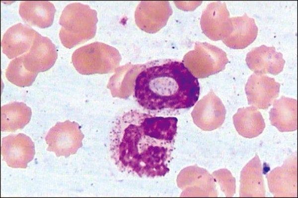 结构特点 作用 生理学变异 病理学变异 药物影响 临床意义 中性粒细胞