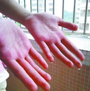 手脚出汗是啥意思?